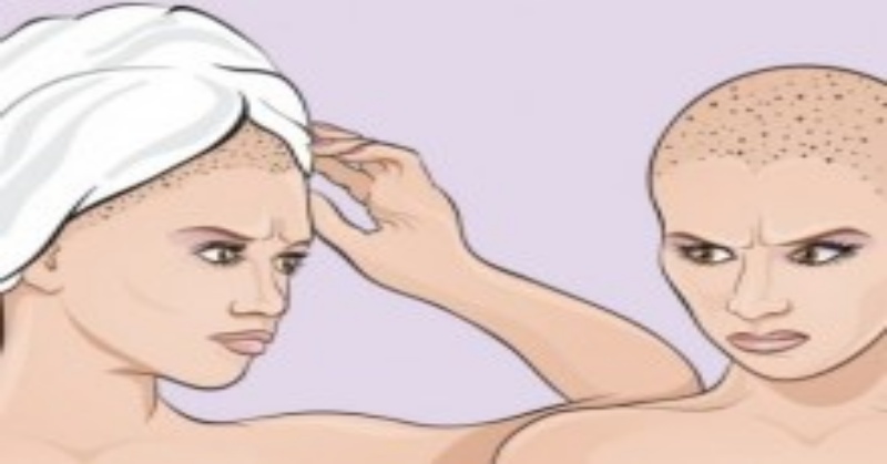 You should stop rubbing the hair with towel. Here’s why