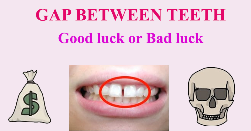 Is The Gap Between Your Teeth A Sign Of Good Luck Or Bad Luck? Here’s What It Means