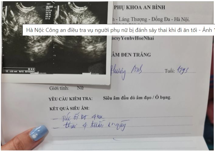 Hà Nội: CA điều tra vụ người phụ nữ bị đ á n h say?thai khi đi ăn tối