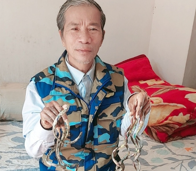 Móng tay dài hơn 1m được rao bán 7 tỷ đồng: Chủ nhân ở Nam Định nói gì?
