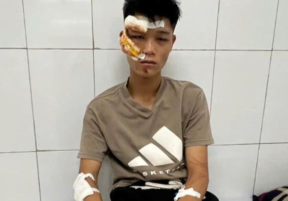Lời khai phẫn nộ của ‘quái xế’ đi vào đường cấm phục vụ A80, tông cảnh sát cơ động