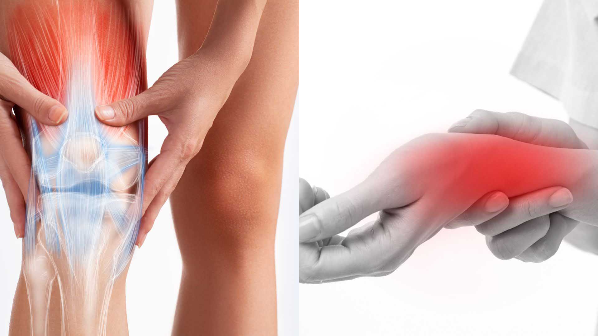 Hai dấu hiệu điển hình của bệnh Chikungunia để phân biệt với sốt xuất huyết