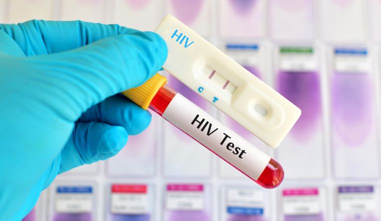 HIV đang trẻ hóa, có trẻ 15-16 tuổi đã mắc bệnh