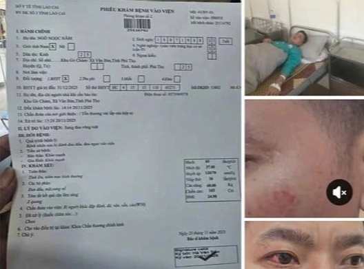 Hiệu trưởng bị tố hành hung giáo viên tại tiệc liên hoan ngày 20/11